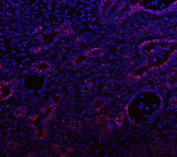 IDH3A Antibody