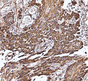 IDH3A Antibody