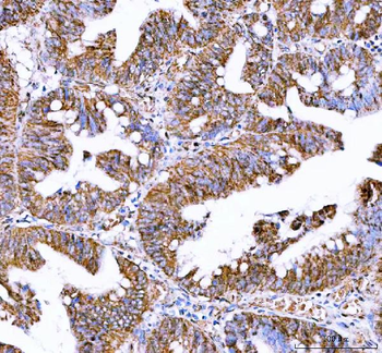 IDH3A Antibody