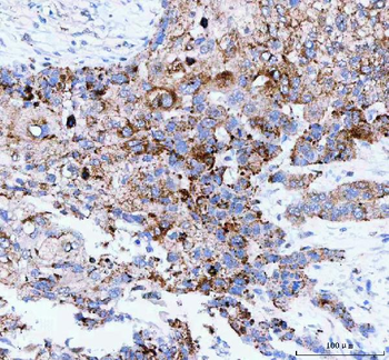JOSD2 Rabbit Polyclonal Antibody