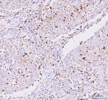 JOSD2 Rabbit Polyclonal Antibody