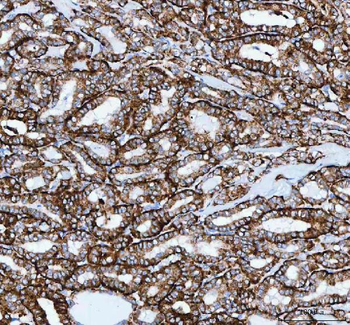 JOSD2 Rabbit Polyclonal Antibody