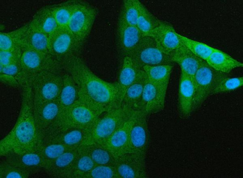 JCHAIN Rabbit Polyclonal Antibody