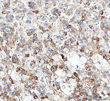 JCHAIN Rabbit Polyclonal Antibody