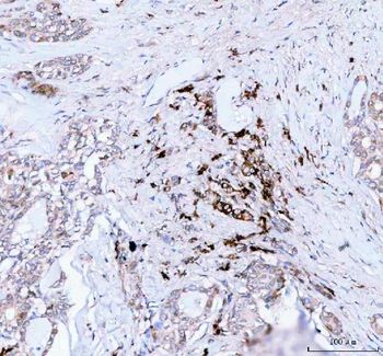 JCHAIN Rabbit Polyclonal Antibody