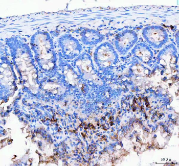 JCHAIN Rabbit Polyclonal Antibody