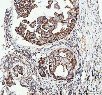 PDK4 Rabbit Polyclonal Antibody