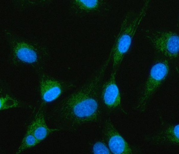 MTF1 Rabbit Polyclonal Antibody