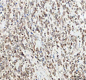 MTF1 Rabbit Polyclonal Antibody