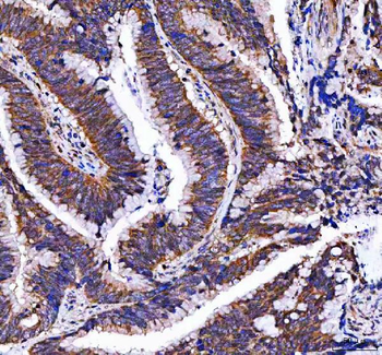 MTF1 Rabbit Polyclonal Antibody