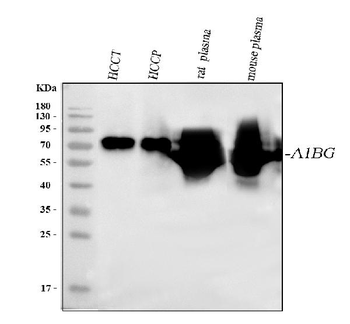 Alpha 1B-Glycoprotein/A1BG/1B Rabbit Polyclonal Antibody