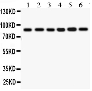 IKK beta/IKBKB Rabbit Polyclonal Antibody