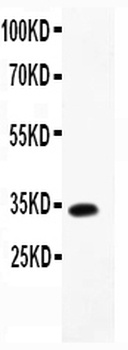 TARC/CCL17 Rabbit Polyclonal Antibody