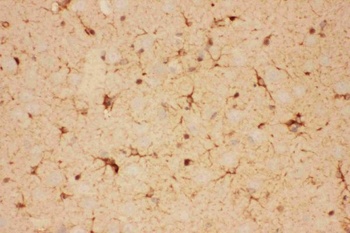 CNTF Rabbit Polyclonal Antibody