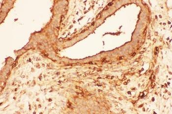 Cofilin/CFL1 Antibody
