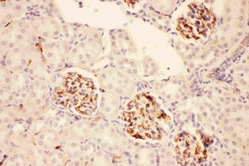 ACTH/POMC Rabbit Polyclonal Antibody