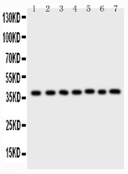 ARA9/AIP Rabbit Polyclonal Antibody