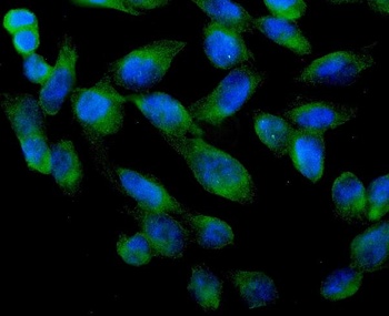 ARA9/AIP Rabbit Polyclonal Antibody