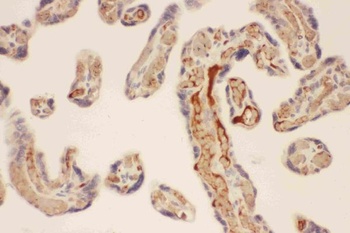 Mast Cell Chymase/CMA1 Rabbit Polyclonal Antibody