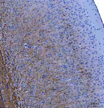 NF68 Nefl Mouse Monoclonal Antibody