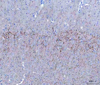 NF68 Nefl Mouse Monoclonal Antibody