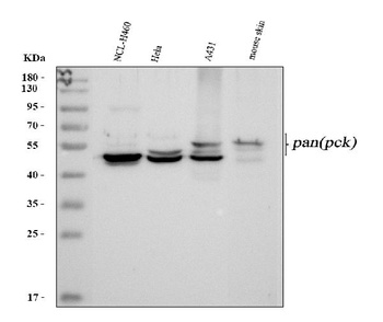 Pan cytokeratin Antibody (Monoclonal, PCK-26)