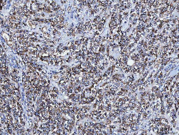 CD166/ALCAM Antibody