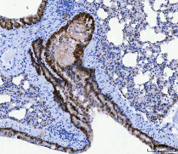 CD166/ALCAM Antibody