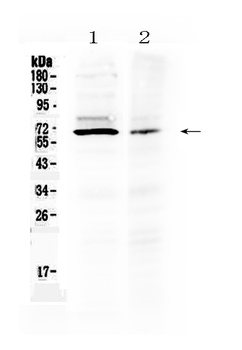 AMH Rabbit Polyclonal Antibody