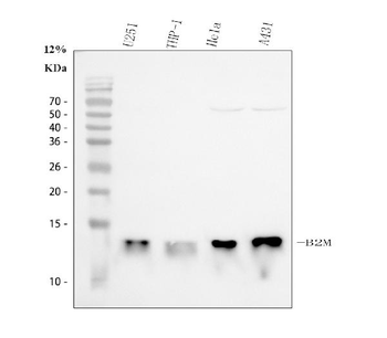 Beta 2 Microglobulin/B2M Rabbit Polyclonal Antibody