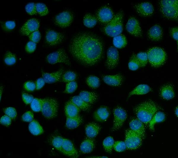 Bag5 Rabbit Polyclonal Antibody