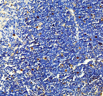 Survivin/BIRC5 Antibody