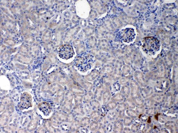 C Reactive Protein/Crp Rabbit Polyclonal Antibody