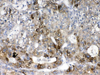 Cytochrome P450 2D6/CYP2D6 Rabbit Polyclonal Antibody