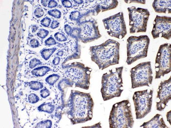 Cytochrome P450 2D6/CYP2D6 Rabbit Polyclonal Antibody