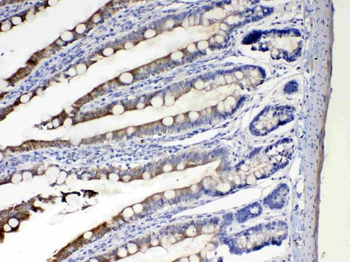 Cytochrome P450 2D6/CYP2D6 Rabbit Polyclonal Antibody