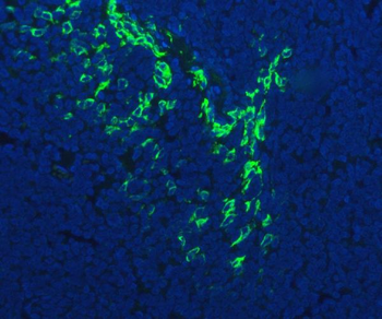 FDCSP Rabbit Polyclonal Antibody