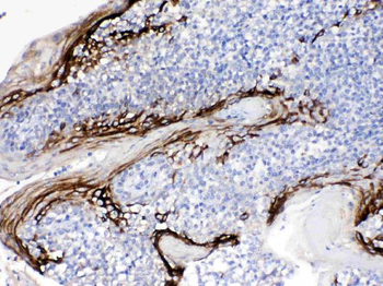 FDCSP Rabbit Polyclonal Antibody
