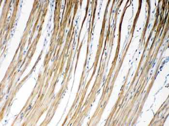 Connexin 45/GJA7/GJC1 Rabbit Polyclonal Antibody