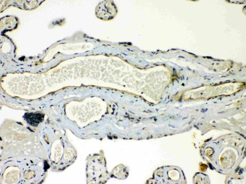 Connexin 45/GJA7/GJC1 Rabbit Polyclonal Antibody