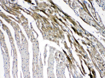 Connexin 45/GJA7/GJC1 Rabbit Polyclonal Antibody