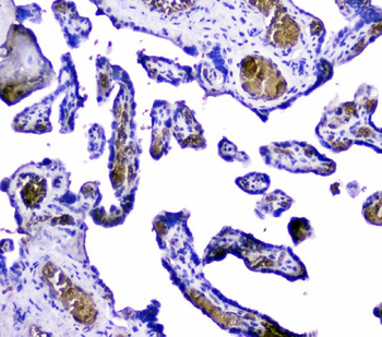 Hemoglobin/HBA1/HBA2 Rabbit Polyclonal Antibody