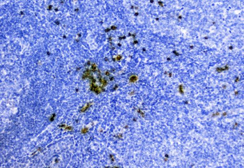 Hemoglobin/HBA1/HBA2 Rabbit Polyclonal Antibody