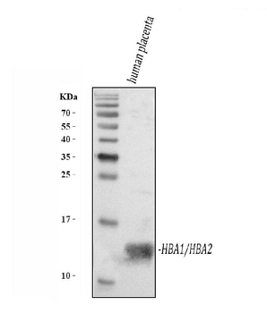 Hemoglobin/HBA1/HBA2 Rabbit Polyclonal Antibody