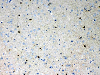 HCN2 Rabbit Polyclonal Antibody