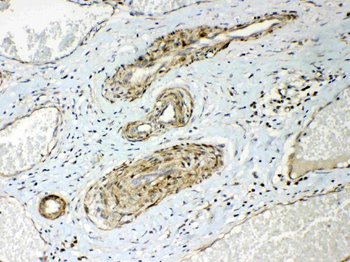 HSPB8/Hsp22 Antibody