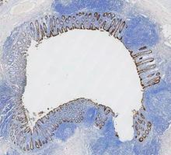 Cytokeratin 8/KRT8 Antibody
