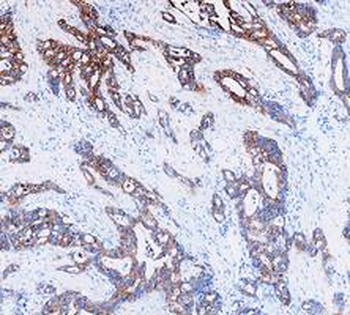 Cytokeratin 8/KRT8 Antibody