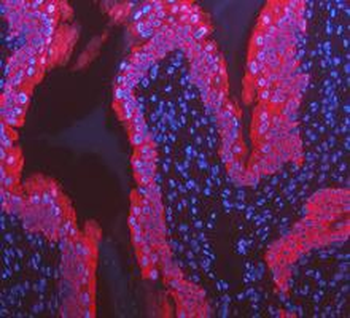 Cytokeratin 8/KRT8 Antibody