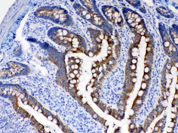 Cytokeratin 8/KRT8 Antibody